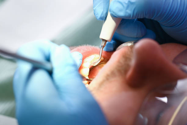 Best Emergency Dental Care for Trauma or Injury in Point Mackenzie, AK